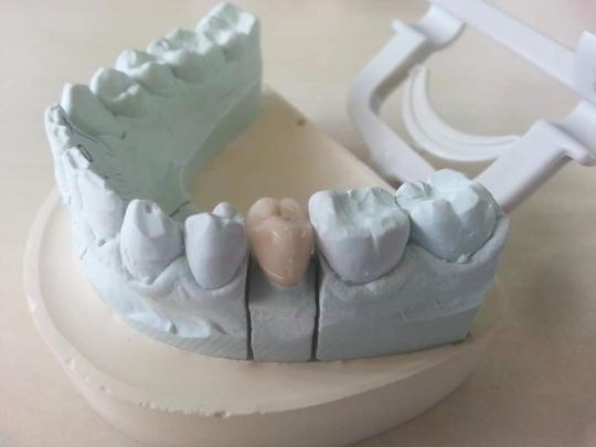 Flexible resin