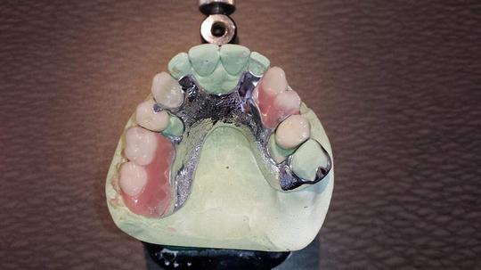 Orthodontics
