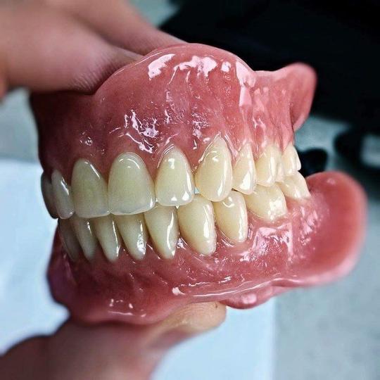 Splints