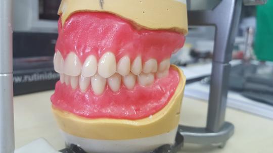 Dentures